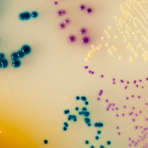 CHROMagar™ Orientation (UTI chromogenic media) (copy)