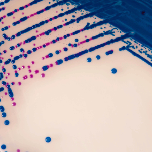 CHROMagar™ StrepB Chromogenic Medium