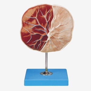 GD Placenta Model
