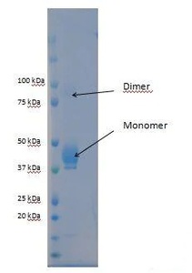 Abcam Recombinant Hepatitis B virus Hepatitis B Surface Antigen AD protein, >95%, 100 µg