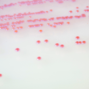 CHROMagar™ MRSA Supplement for 5L medium