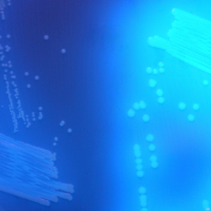 CHROMagar™ C. difficile, for 5L Medium