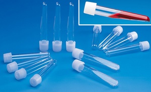 Thermo Scientific™ Nunc™ Cell Culture Tubes