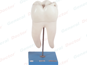 GD Dental Caries Model