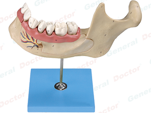 GD Lower Jaw of 18-Year-Old Model