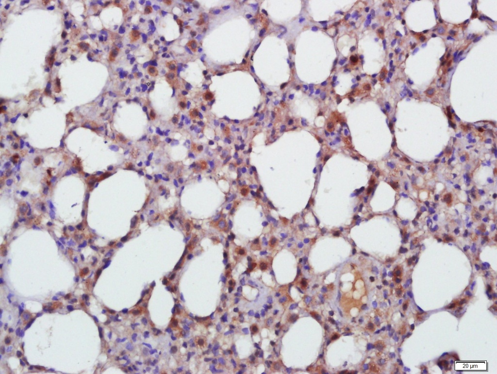 [BS-20411R-HRP] Bioss™ TGF beta 1 Polyclonal Antibody, HRP, 100 µL