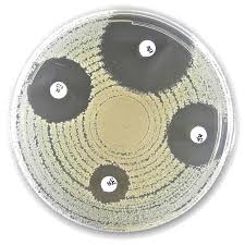 Liofilchem® Amoxicillin Antimicrobial Susceptibility Discs, 5µg, 250 Discs/Pack